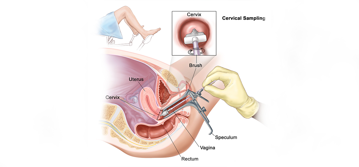 cervical-sampling