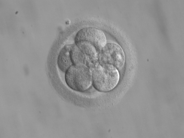 embryoscope