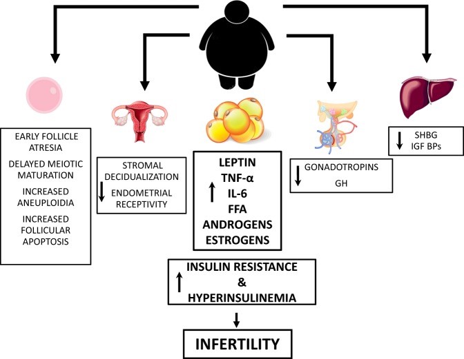 Obesity and female infertility