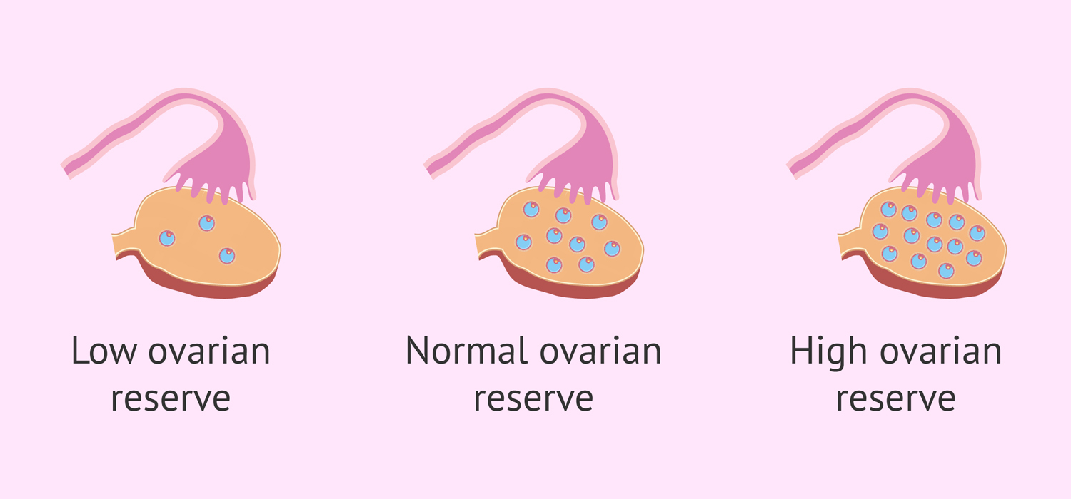 Poor Ovarian Response