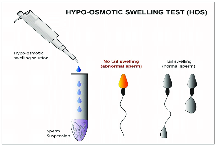 sperm vitality tests