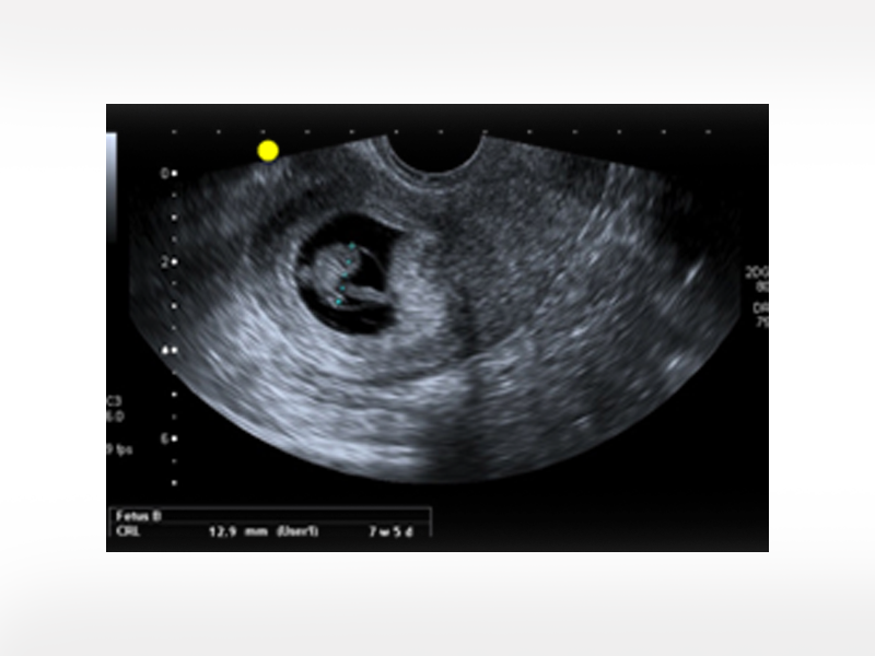 first trimester ultrasound course