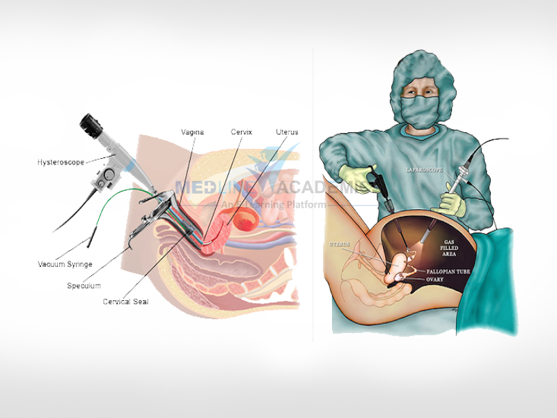 Training In Endoscopy, Hysteroscopy And Laparoscopy