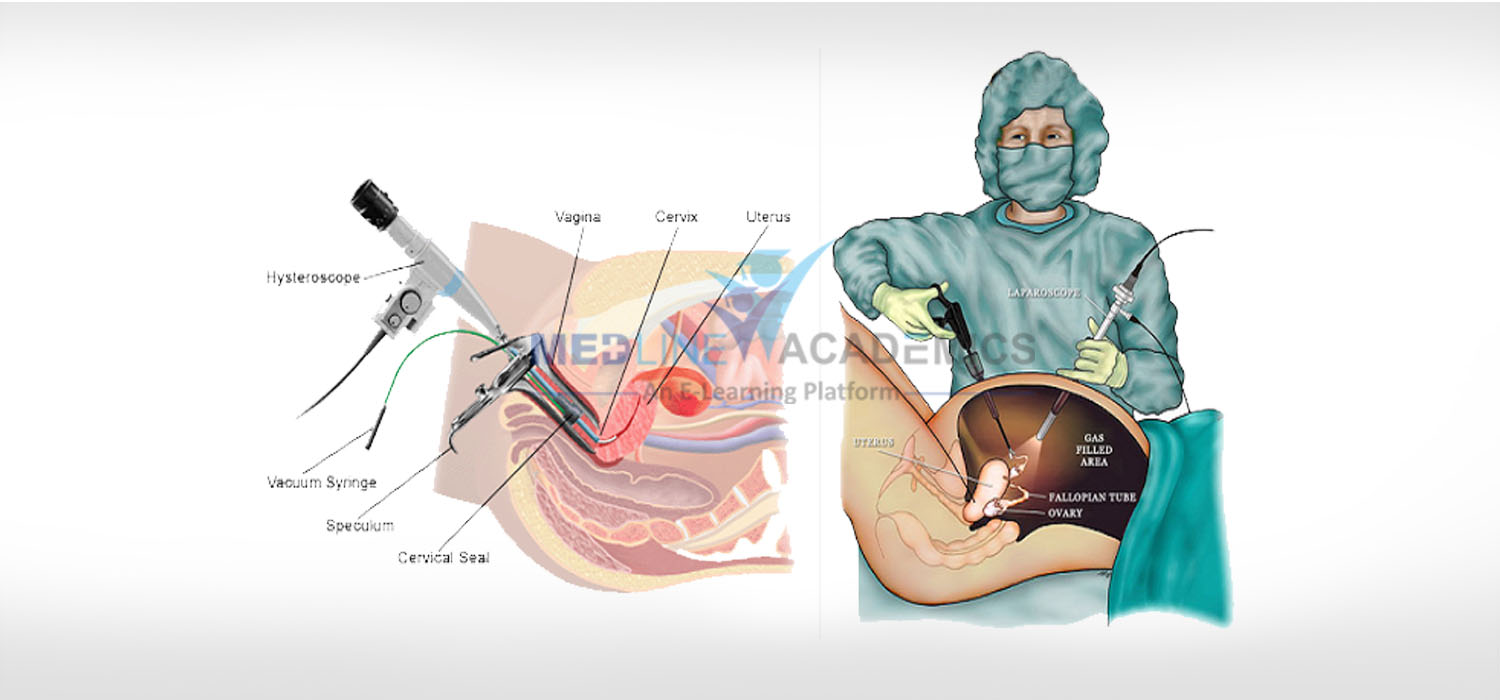 training in endoscopy hysteroscopy and laparoscopy